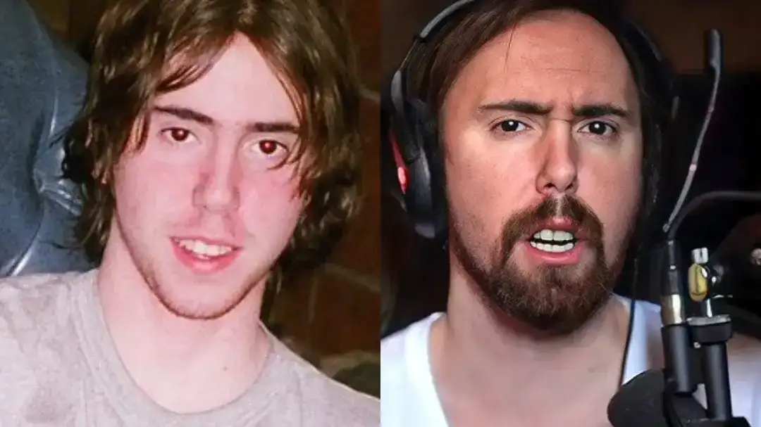 Asmongold parece um rato dentes: streamer alerta sobre higiene bucal após foto chocante